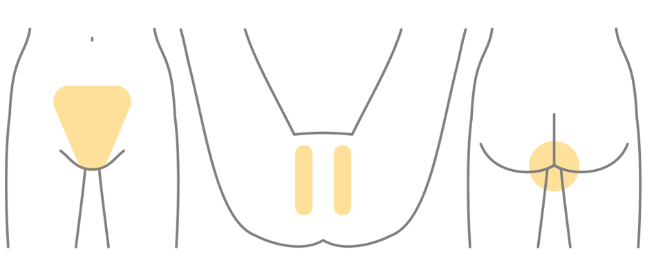 VIO